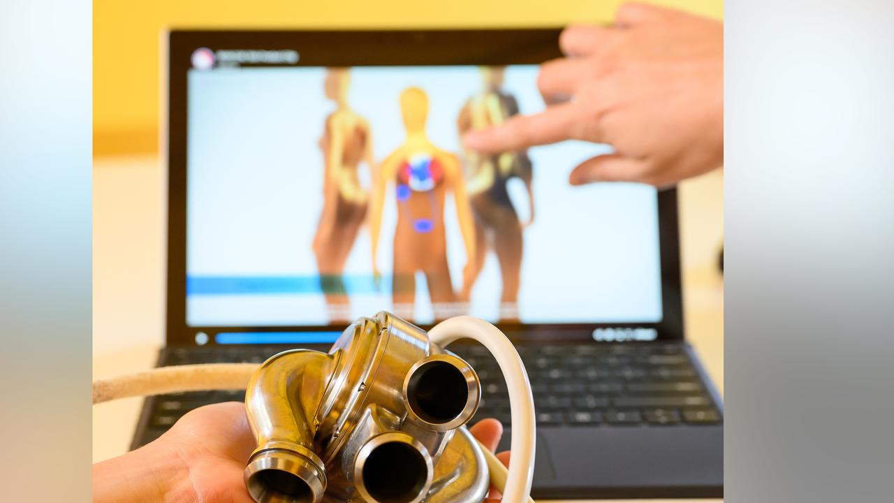 a BiVACOR Total Artificial Heart