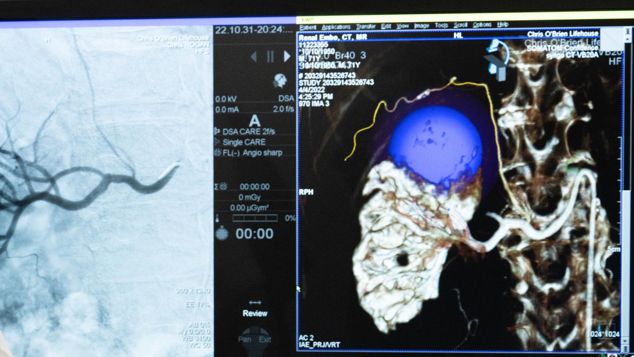 Interventional Oncology Operating Suites at Chris O'Brien Lifehouse