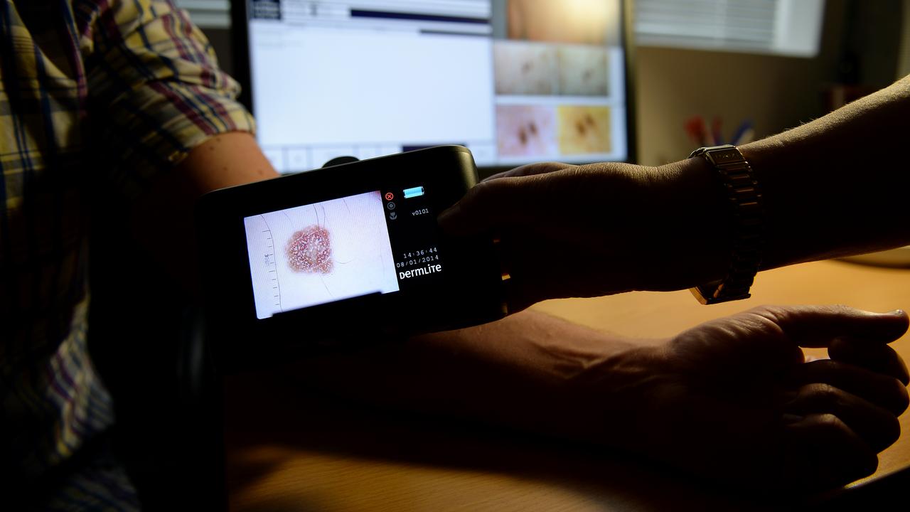a patient being checked for skin cancers