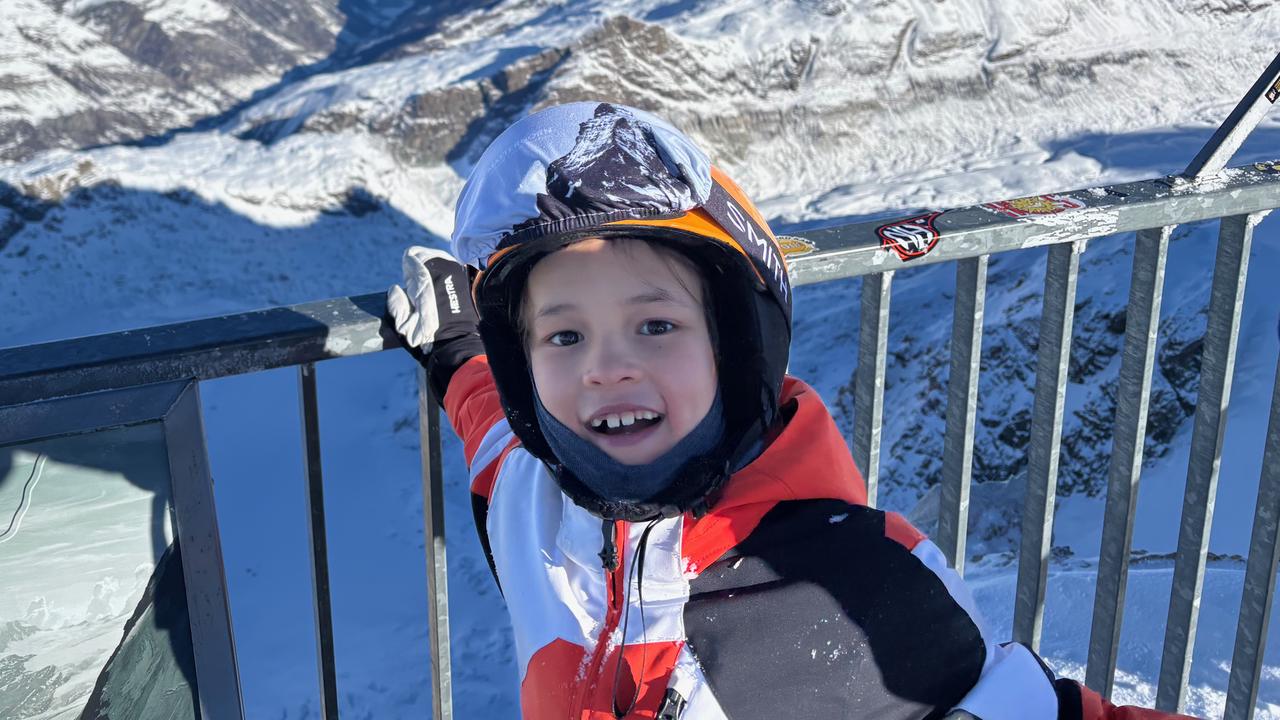 Food allergy sufferer Edward